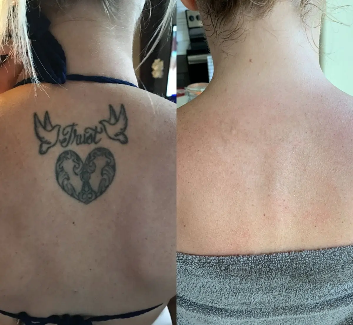 Michelle tattoo fading results